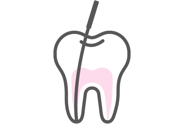 根管治療