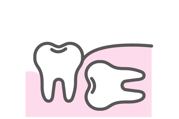 TOOTH EXTRACTION